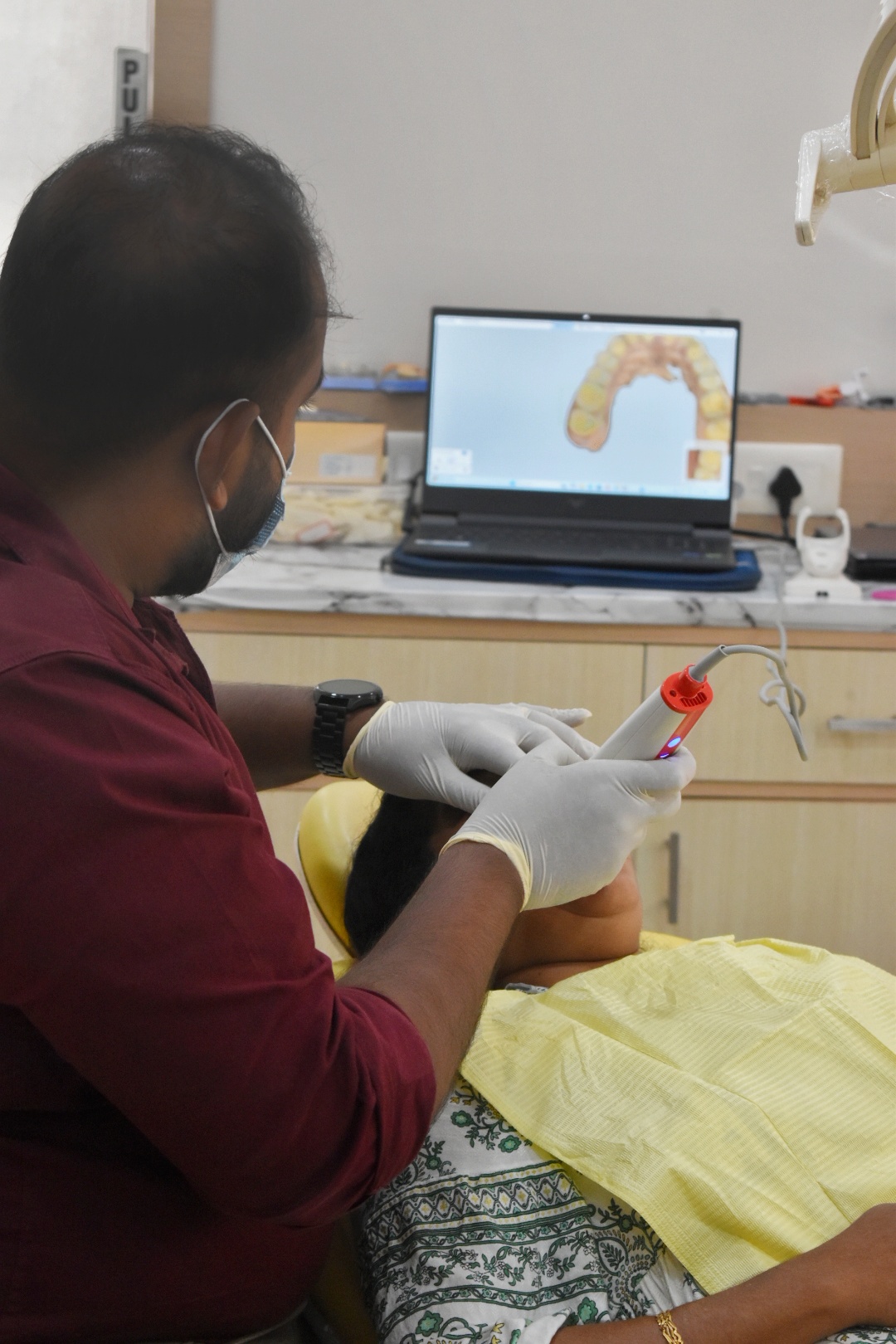Intraoral Scanner