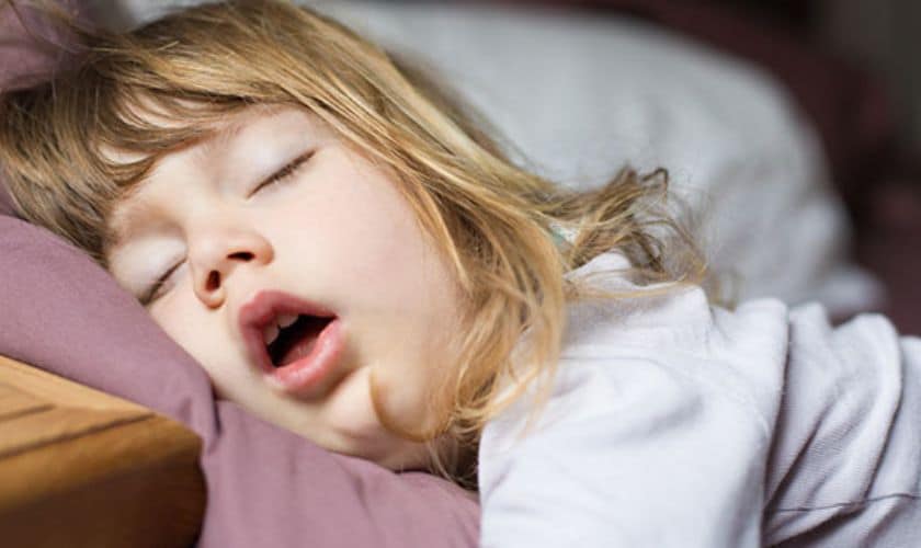 Treatment for mouth breathing 