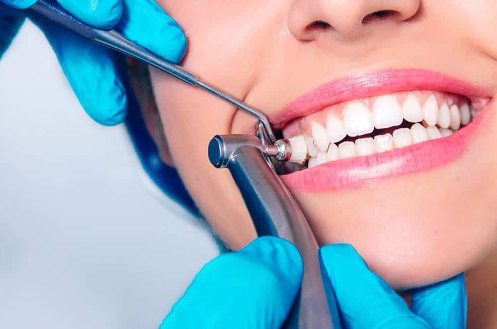 Dental Cleaning & Filling