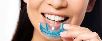 Mouthguard