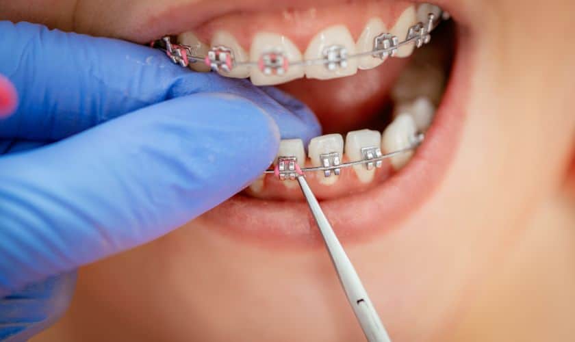Orthodontic & Aligner Treatment