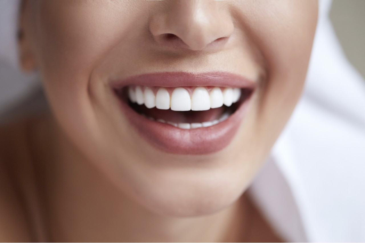 Single sitting smile correction